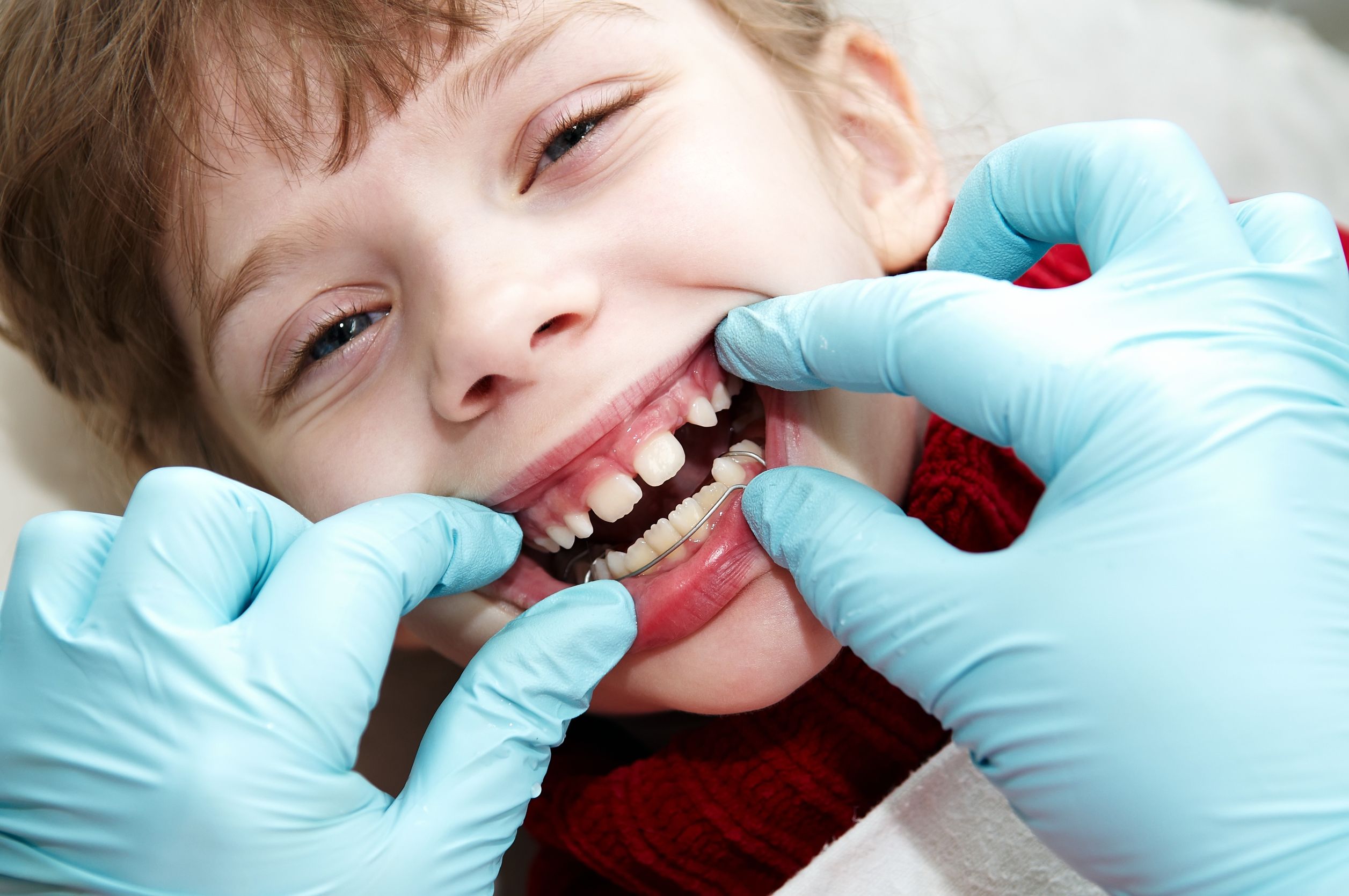 The Importance of Early and Ongoing Pediatric Dental Care in Warrenton VA