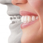 Things General Dentists Beaver Dam WI will Tell You about Gum Disease