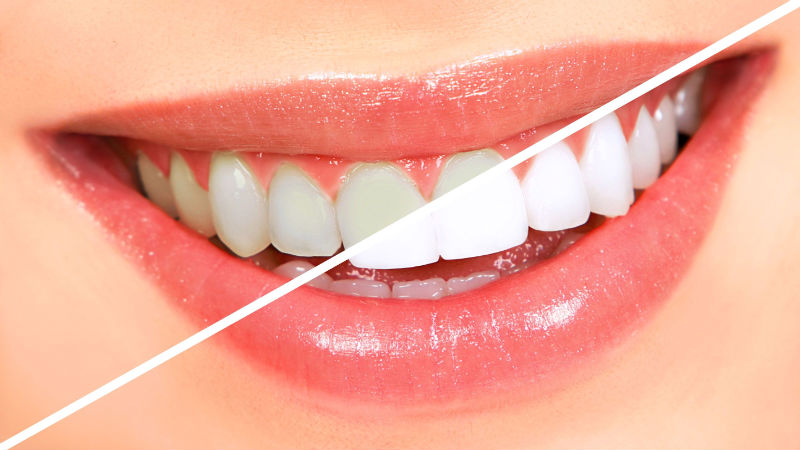 Carrier Dentist Services Help Prevent Oral Health Concerns