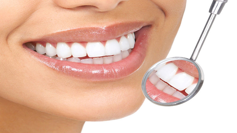 Advantages of Professional Teeth Whitening Roseburg Oregon