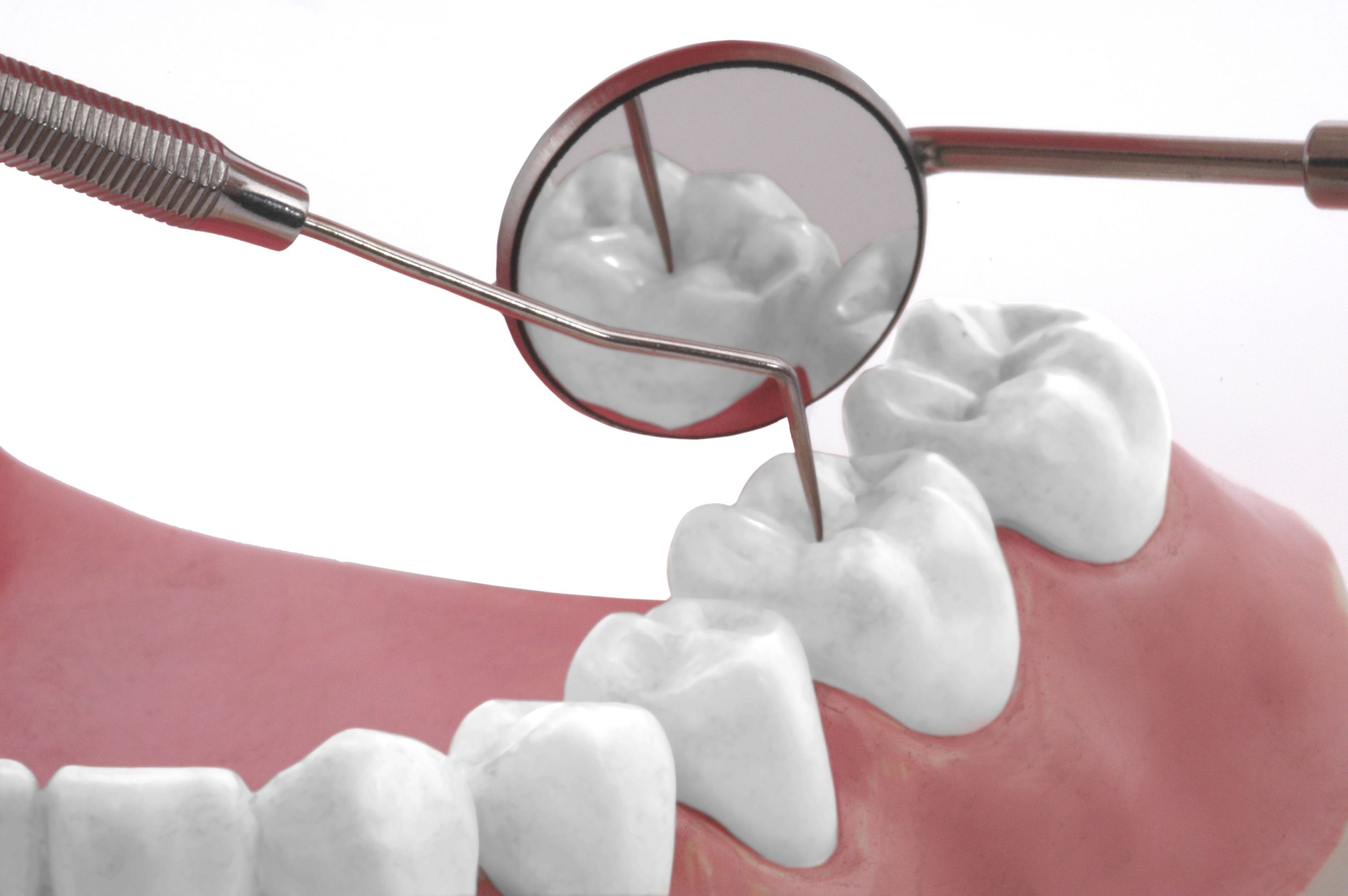 Information You Need to Know before Arranging Periodontal Disease Treatment in Marion, IA